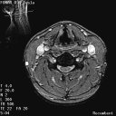 The Stand-Up MRI Imaging Capabilities for the Cervical.