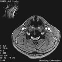 The Stand-Up MRI Imaging Capabilities for the Cervical.