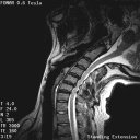 The Stand-Up MRI Imaging Capabilities for the Cervical.