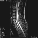 The Stand-Up MRI Imaging Capabilities for the Cervical.