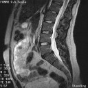 The Stand-Up MRI Imaging Capabilities for the Lumbar.