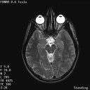The Stand-Up MRI Imaging Capabilities for the Brain.