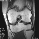 The Stand-Up MRI Imaging Capabilities for the Knee.