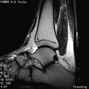 The Stand-Up MRI Imaging Capabilities for the Ankle.